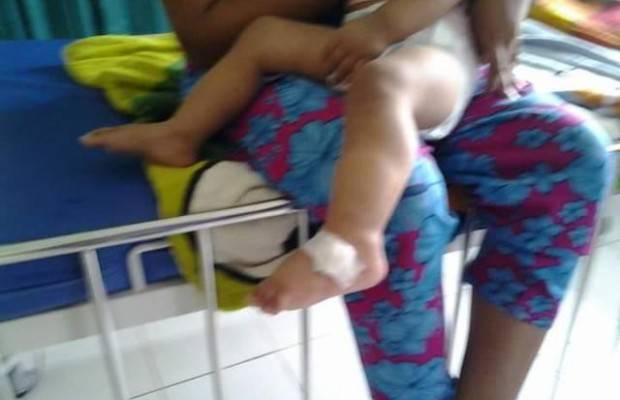 Pasien Dias digendong orang tuanya saat mengalami bengkak pada bagian kakinya usai diinfus